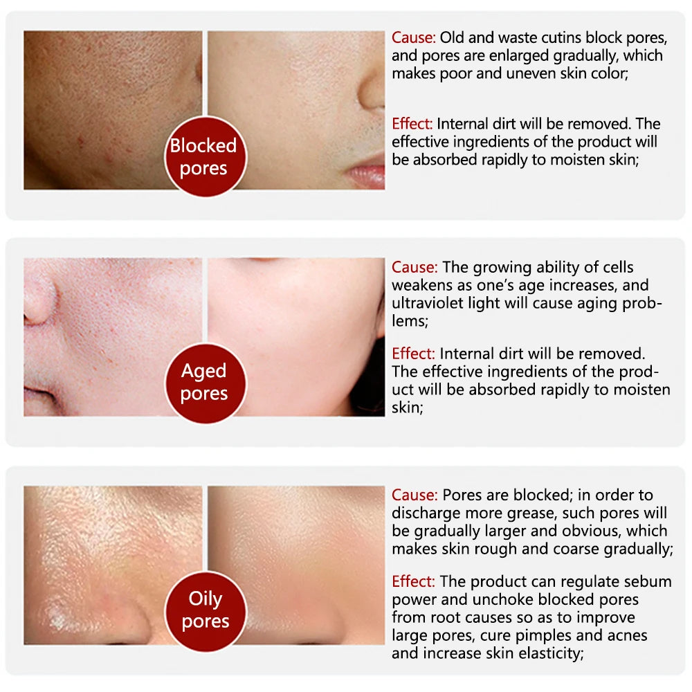 Pore treatment serum