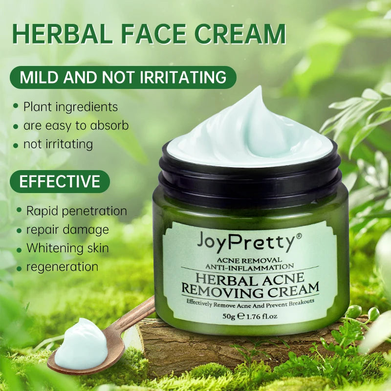 Acne Treatment Cream - Natural Herbal Formula